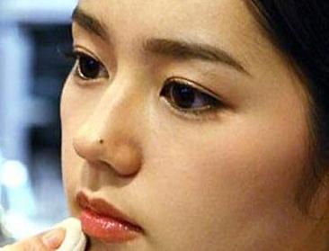下巴有颗痣的女明星,揭秘下巴有痣的美丽女明星